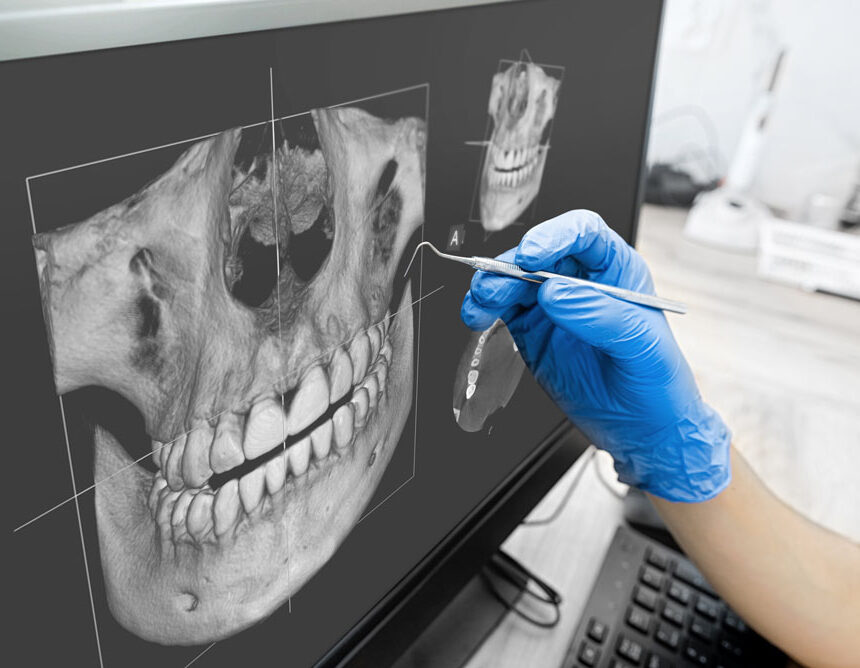 Behandelaar beoordeelt een 3D-scan van het kaakbot voor de planning van een implantaatbehandeling.