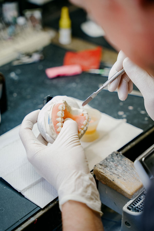 Tandtechnicus werkt aan een implantaatprothese voor een optimale pasvorm en een natuurlijk resultaat.